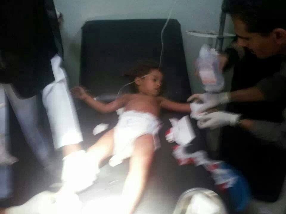 اصابة طفلة بشبوة برصاص الجيش اليمني